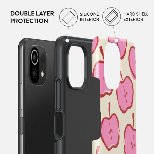 Bon Appétit - Xiaomi 11 Lite 5G NE Case 2