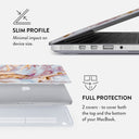 Frozen Leaves - Macbook Case 18