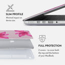 Fragile Beauty - Macbook Case 18