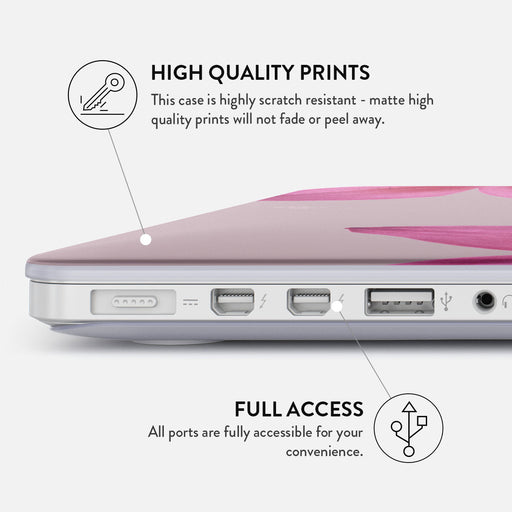 Fragile Beauty - Macbook Case 20